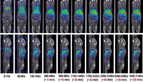 EBET易博PET/CT分子影像手艺平台