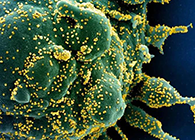 唾液检测新冠抗体新要领来了，获取效果仅需几小时！！！