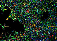 天下首创：药物将干细胞指导至受损部位，提高其愈合能力！！！