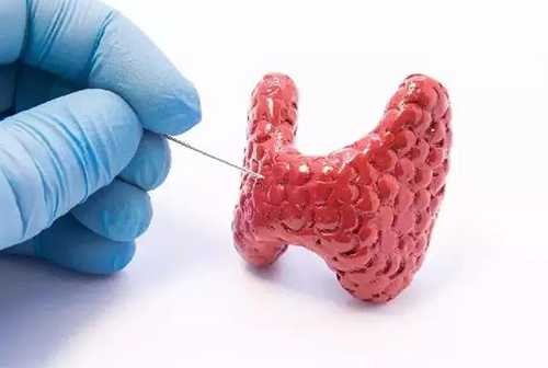 甲状腺疾。，，包括甲状腺功效减退和甲状腺功效亢进，，，自古以来就是重复被医学研究职员研究的疾病